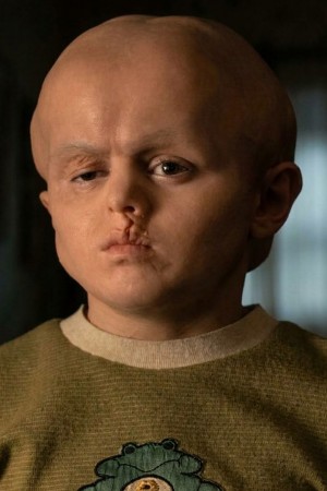 Callum Vinson